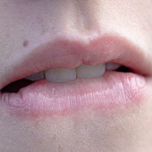 Photo Laurent Castellani